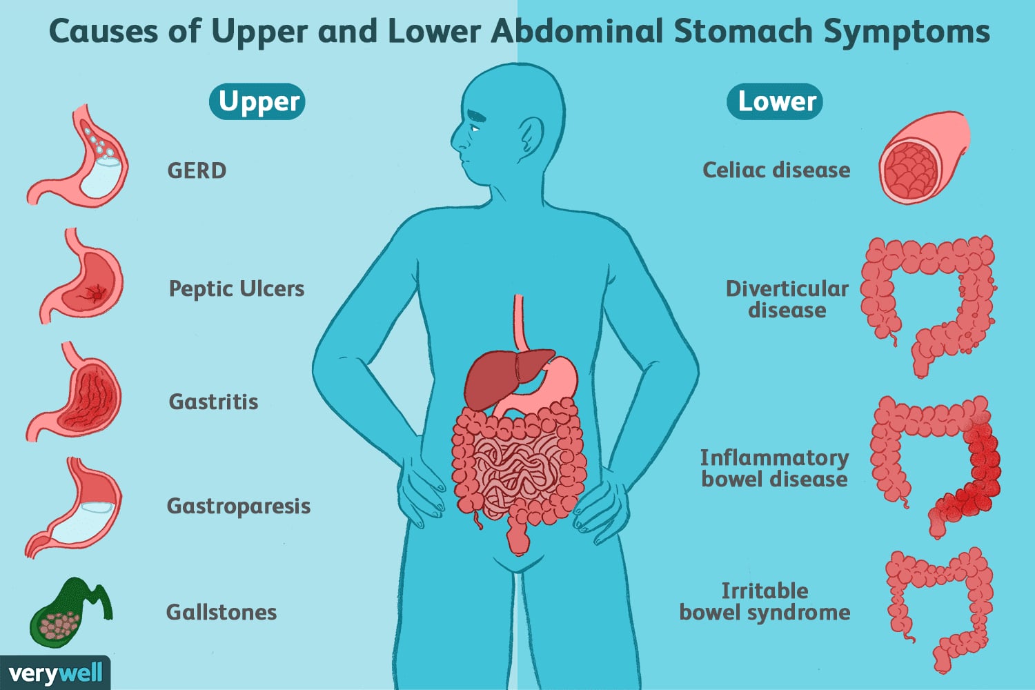 Digestive Problems and IBS