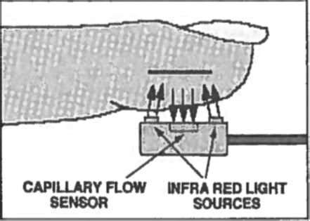 Digital Plethysmography Method