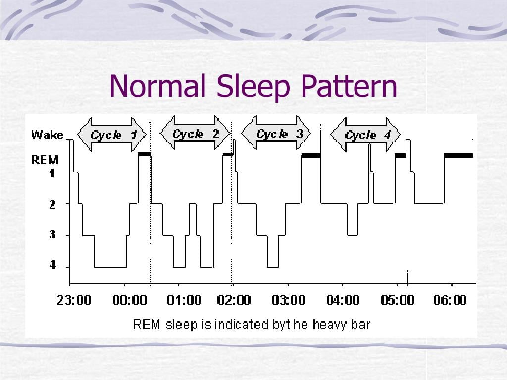 Disrupted Sleep Patterns