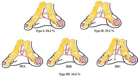 Toe Web Method